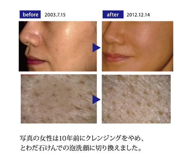 10年前にクレンジングをやめ、とわだ石けんでの泡洗顔に切り換えました。